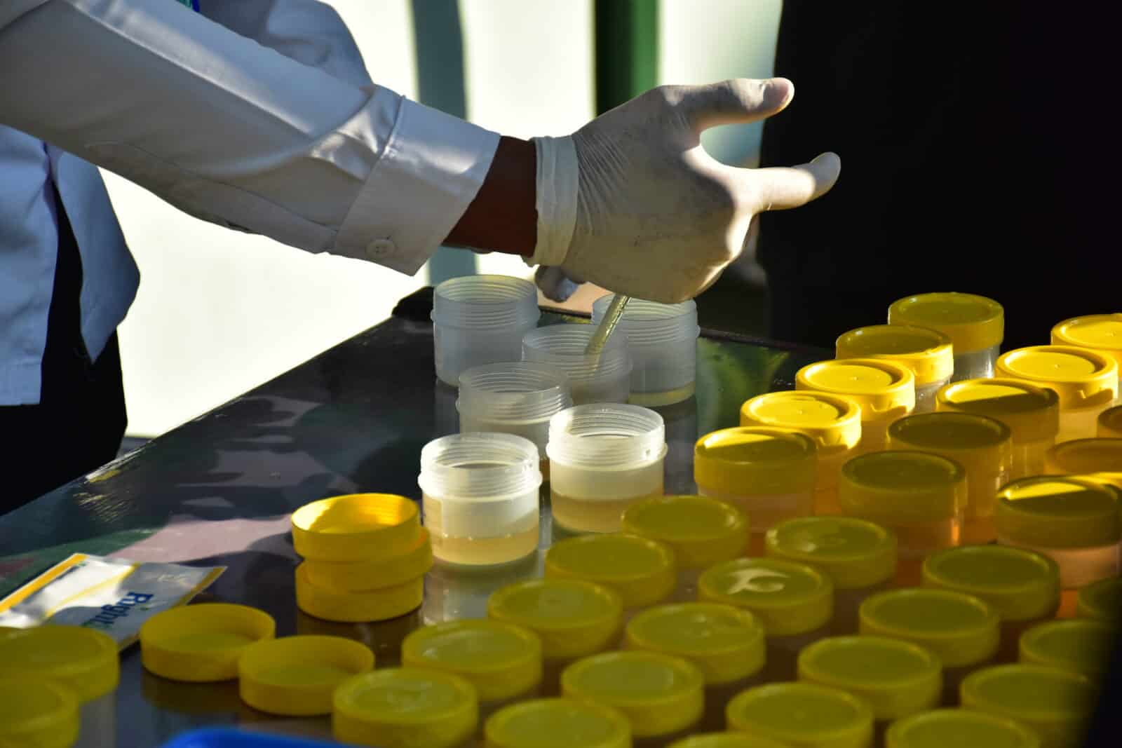 PELAKSANAAN KEGIATAN SOSIALISASI DAN TEST URINE DI KODIM 0821
